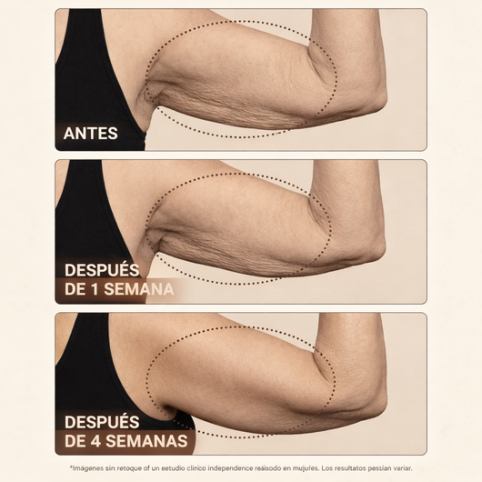 eskin™ REFIRM – Crepey Skin Repair Treatment